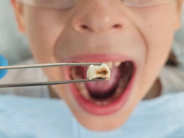 Best Urgent Dental Care in Chapman, KS